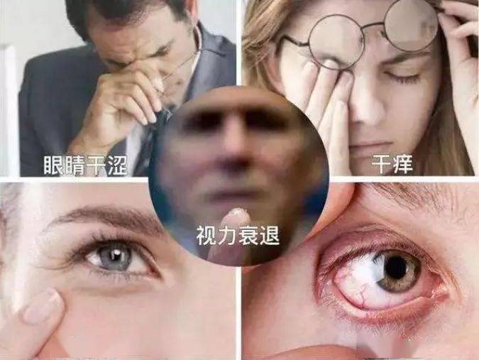 眼睛莫名干痒刺痛?99%是因为ta,教你一招,果断和眼部疲劳说拜拜