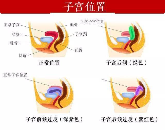 子宫后位是什么意思4种表现说明子宫后位