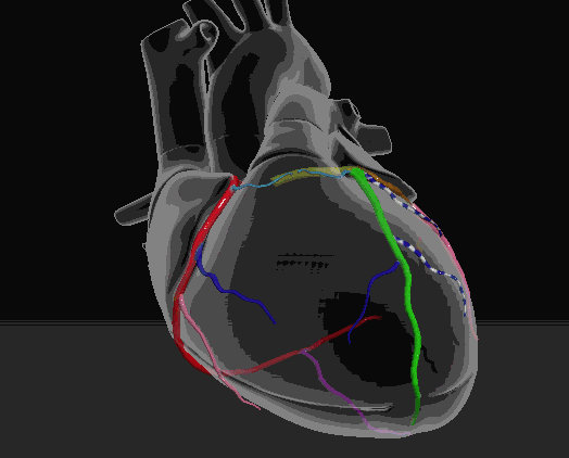 心肌桥常见于  左前降支(lad)的中段,冠状动脉造影的检出率为1.