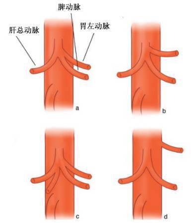 腹腔干详细解剖_主动脉