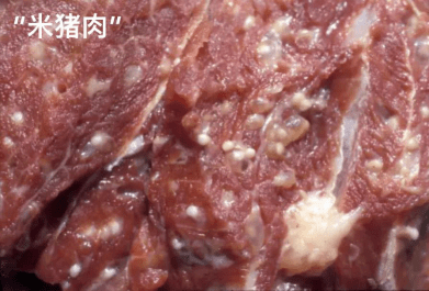 若食用未煮熟的"米猪肉",受感染的囊尾蚴可固着在人的肠壁上,逐渐发育