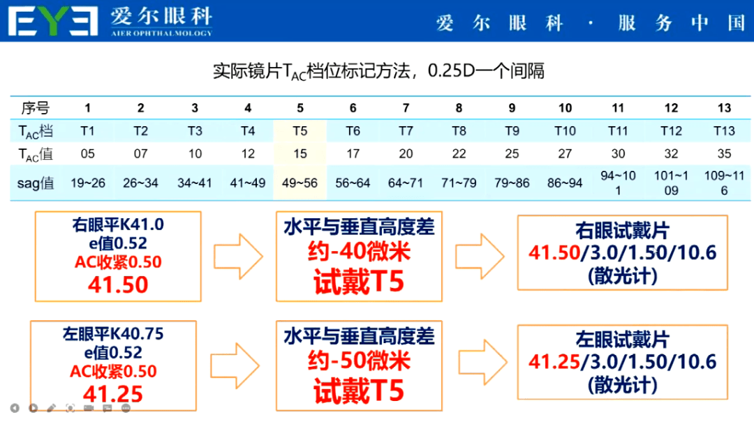 广州爱尔眼科医院李剑华主任:成功验配普诺瞳ok镜四步曲_角膜_镜片