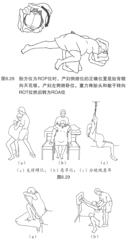 助产知识第二产程头盆不称时产妇的体位