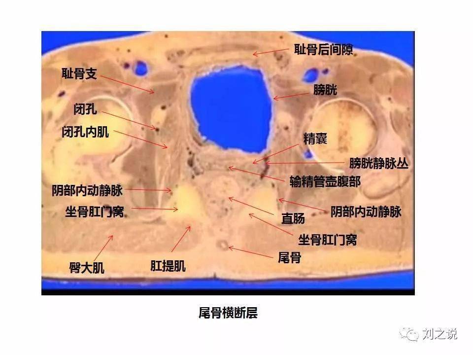 收藏必备:男性盆腔断层解剖_全网_影像_系统