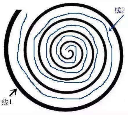 专家提醒:有些年轻人头晕是因为劲椎病,但是不可忽视身体的任何症状