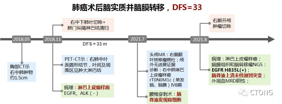 一例肺癌术后复发单发脑及脑膜转移病例讨论丨广东大会诊