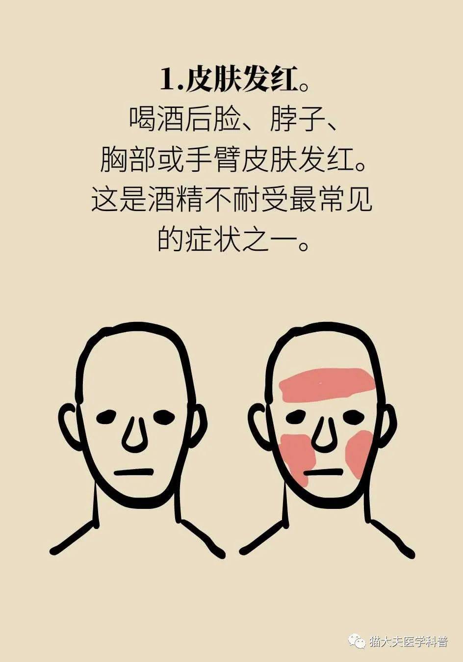 一喝酒就脸红,到底是酒精过敏还是酒精不耐受?_参考_人士_医学