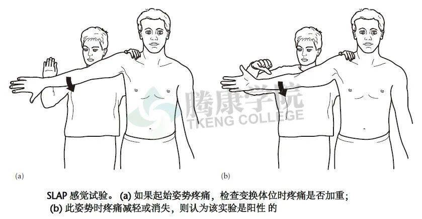 【千查万别】肩关节的特殊检查_患者_肱骨_试验