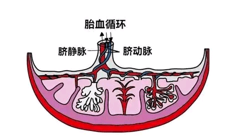 产前诊断脐血管栓塞病例极少,当一条脐动脉栓塞时,血流阻断,超声下极