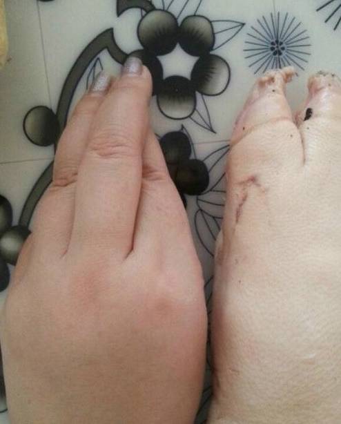原创
幽默笑话:小朋友,这么热的天就不要在街上煎蛋了,容易中暑的