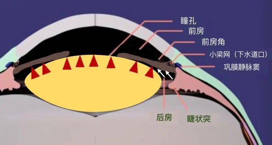 在切开前房或前房穿刺时房水溢出,马上又有新的房水产生,此时所产生的