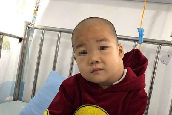3岁男童脸大如盆,母亲不敢再向枕边人要钱:毕竟没有血缘关系_妈妈