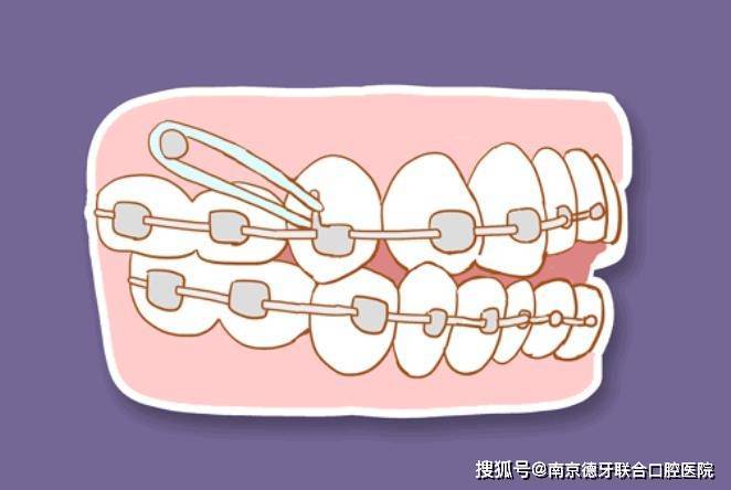 成都借卵机构（南京牙齿矫正专业的医院十大排名_南京牙齿矫正多少钱）