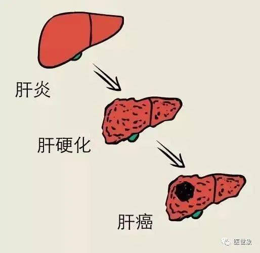 继发性肝癌可通过多种不同途径,比如随血液,淋巴液转移或直接浸润肝脏