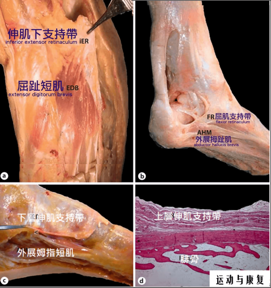 短肌」与「伸姆趾短肌」这两条足背上的肌肉会与「伸肌下支持带」连接