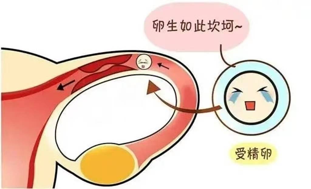 成都做三代试管婴儿多少钱（速看）