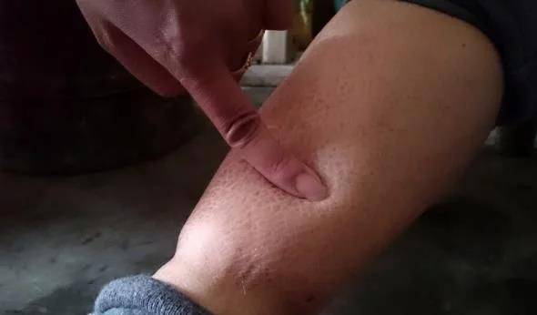 男性开始衰老，下肢会出现这些情况，如果没有说明还年轻