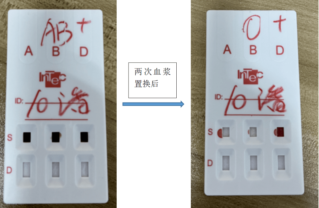 让我惊出一身冷汗的冷凝集标本_检验_结果_血浆