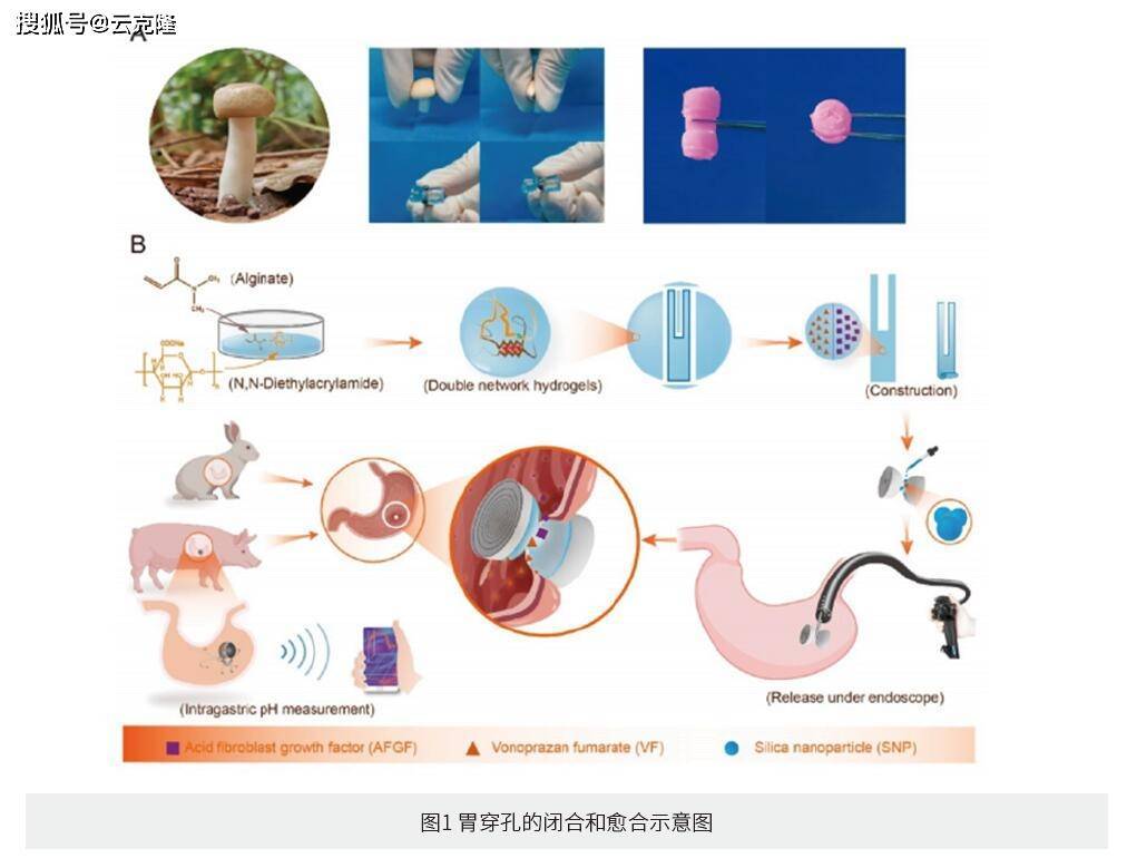 内镜下可递送和蘑菇帽启发的双曲面形载药生物粘附