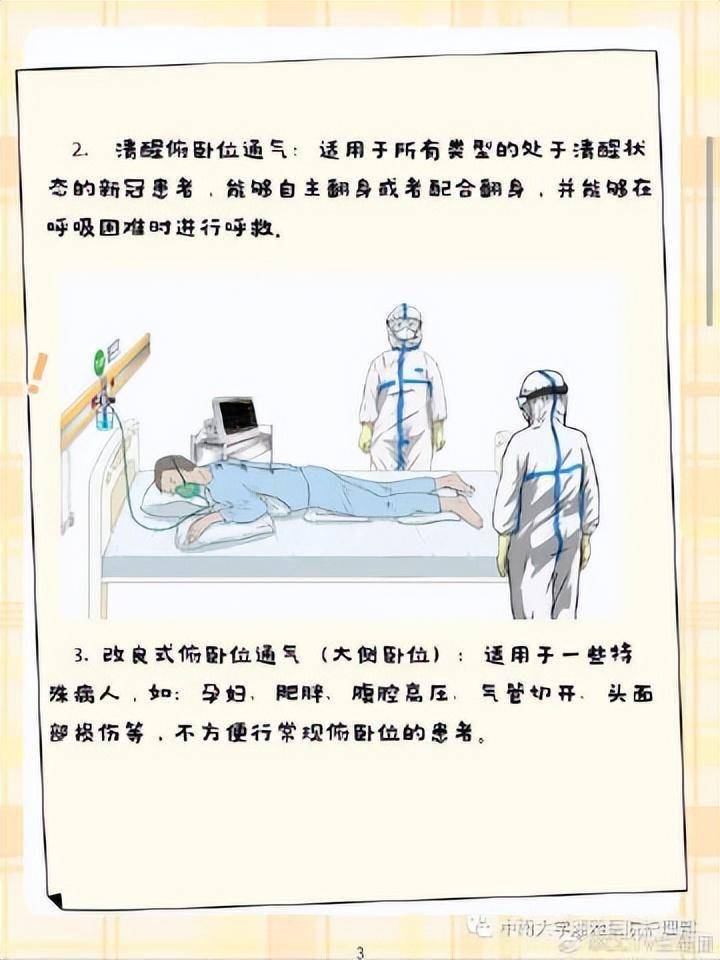 什么是俯卧位通气？