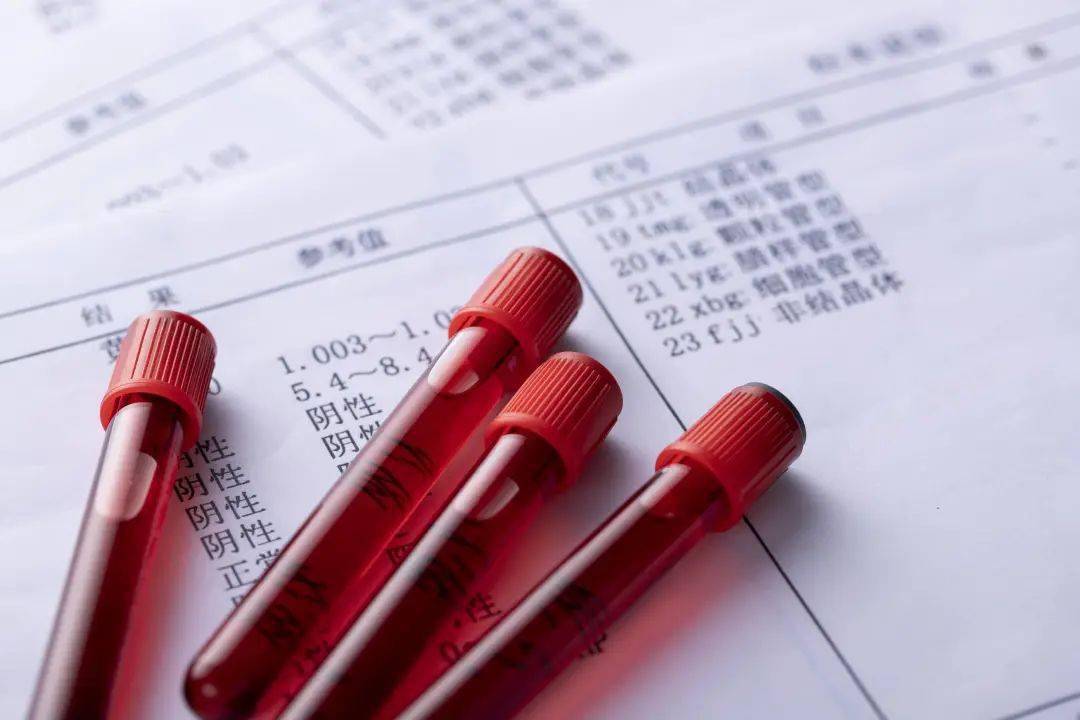 为什么体检要抽好几管血？血检化验单该怎么看？