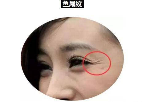 女人眼角鱼尾纹面相图片