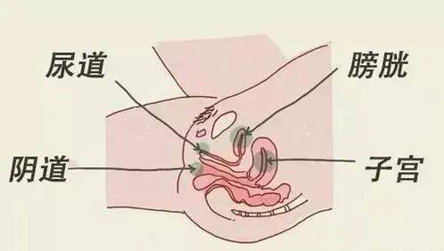女性尿道口疼痛图片