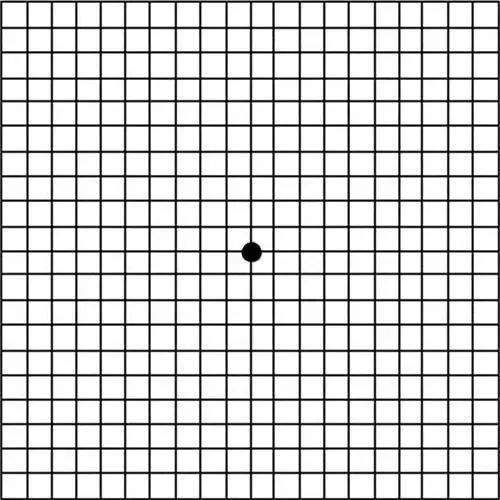 视野自我测试图图片