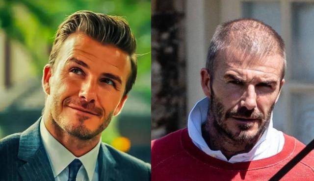 帅气也挡不住脱发的10位男明星你知道还有谁