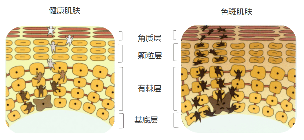 暗黃,斑點皮膚分析