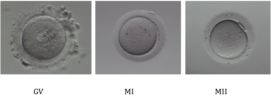 (图:卵母细胞成熟经历三个阶段:gv