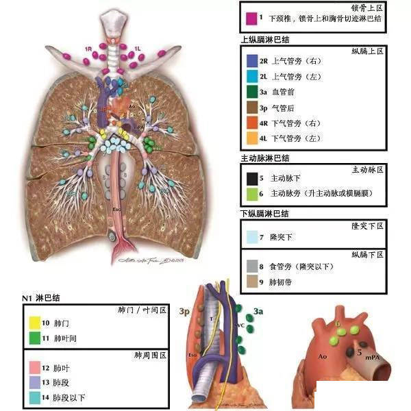 今日分享縱隔淋巴結分區圖譜