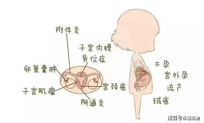 包括子宫颈阴道(即子宫下端通向阴道的部分)炎症及子宫颈管黏膜炎症