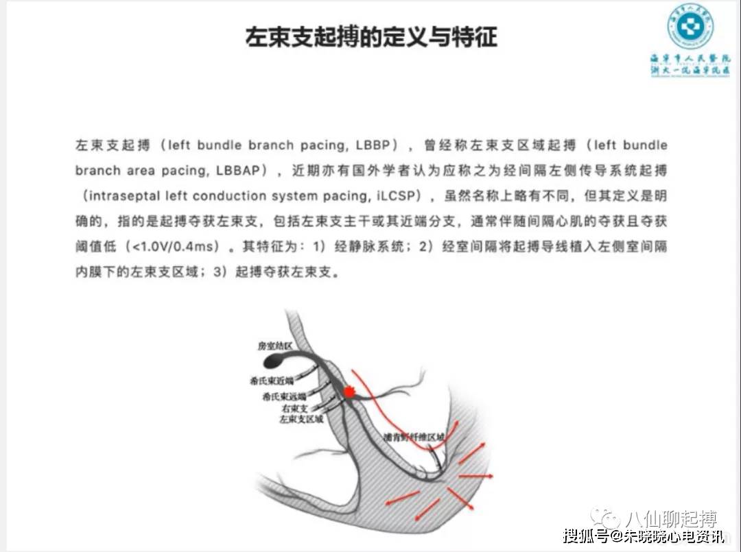 吉亚军老师左束支起搏心电图分析