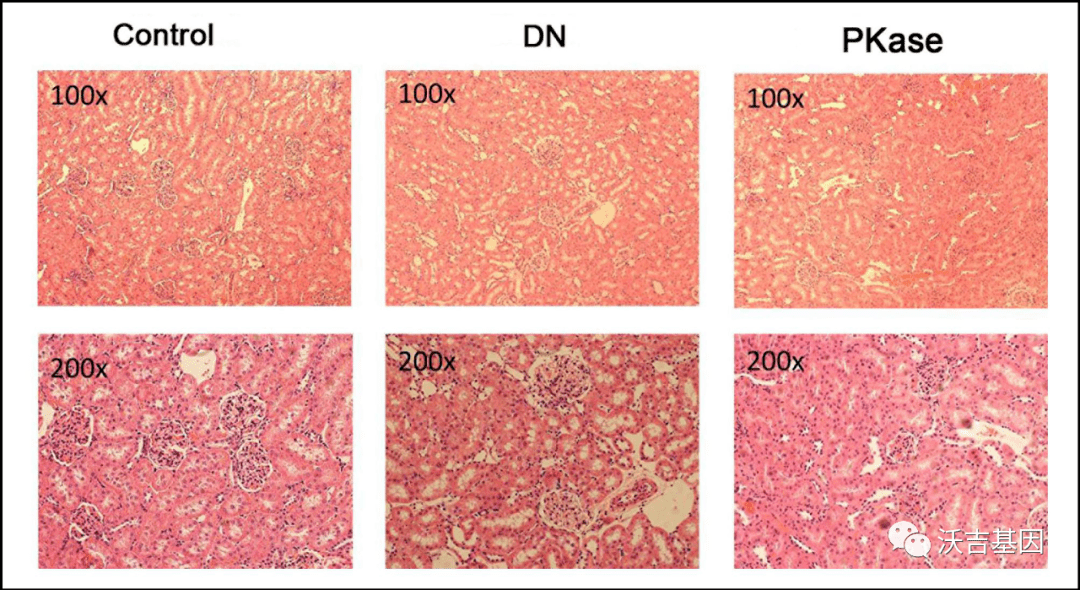 此外,masson三色染色显示dn组肾