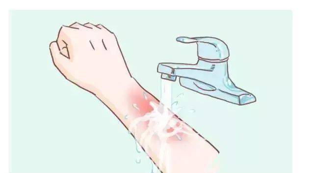 烫伤怎么处理 来自搜狐网