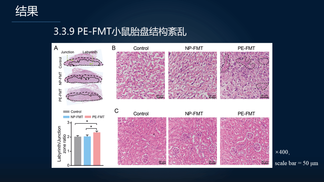 周宏伟面对高致命孕期疾病我们如何在肠道找到突破口
