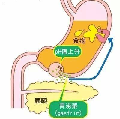 胃酸过多怎么解决图片