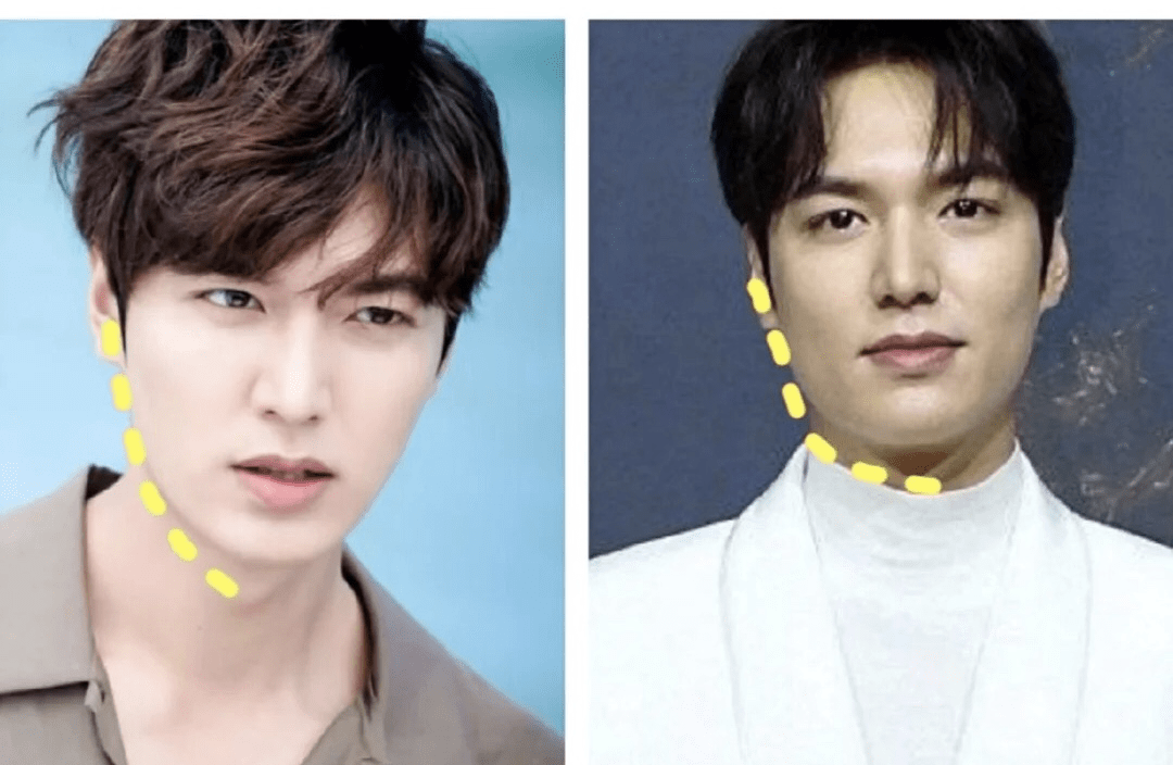 刘亦菲胖了?天仙也逃不脱发腮的命运