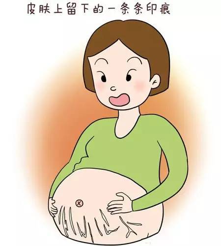 颜无痕小课堂:妊娠纹会导致乳房下垂吗_皮肤