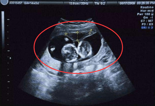 怀孕24周宝宝多大图片图片