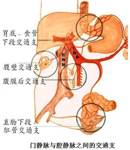 使淤滞在门静脉系统的血液回流,这些交通支大量开放,而建立侧支循环