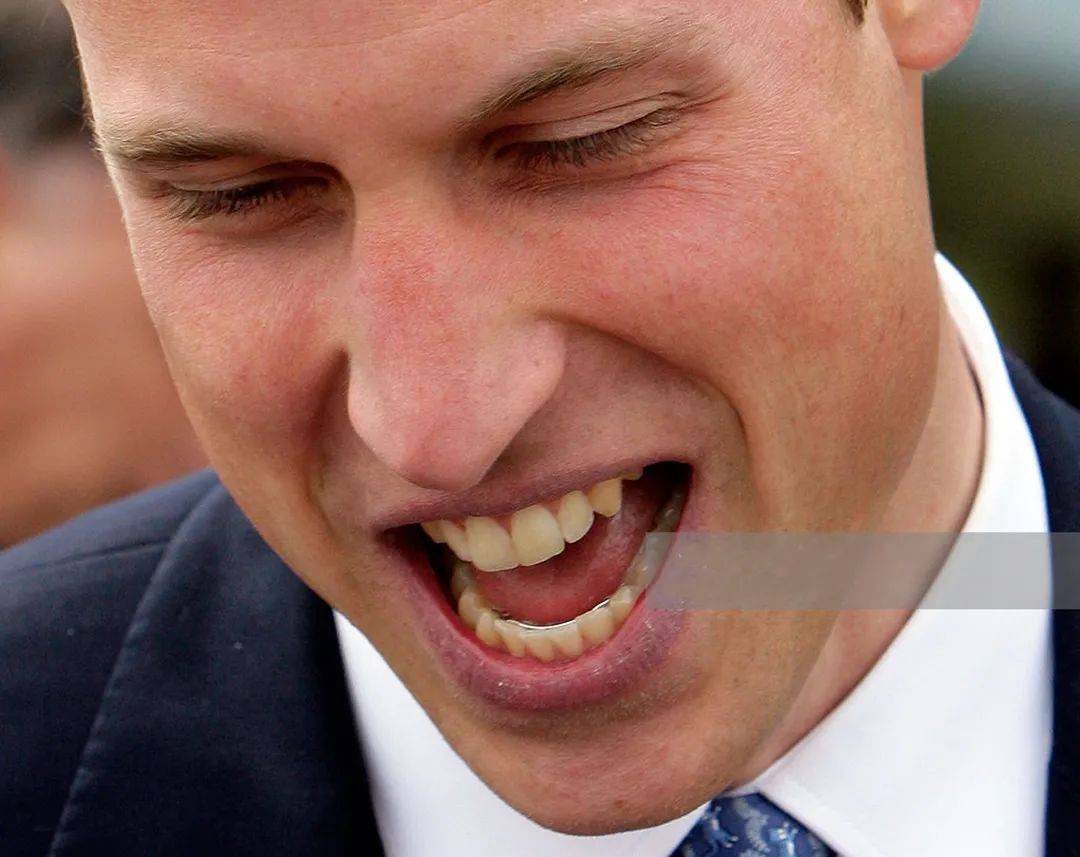 英国王室怪事,公主们不是豁牙就是龅牙,到底是谁将基因带跑偏了