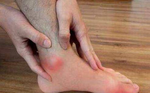 尿酸高,为什么会引起痛风?明白这4点原因,有利于控制尿酸