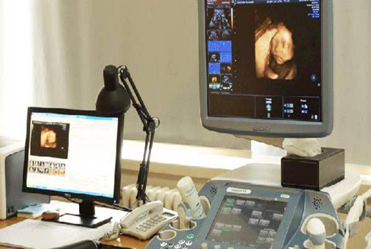 二维VS三维、四维，孕妈妈选哪种超声“更清晰”？|四维|超声|VS|四维彩超|四维超声|胎儿|检查|图像|-健康界