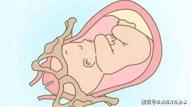 胎儿入盆图片
