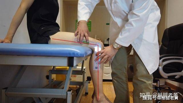 掰腿老黄 08-20 10:41 · 康复治疗师 点击查看更多订阅内容> 膝菇谮