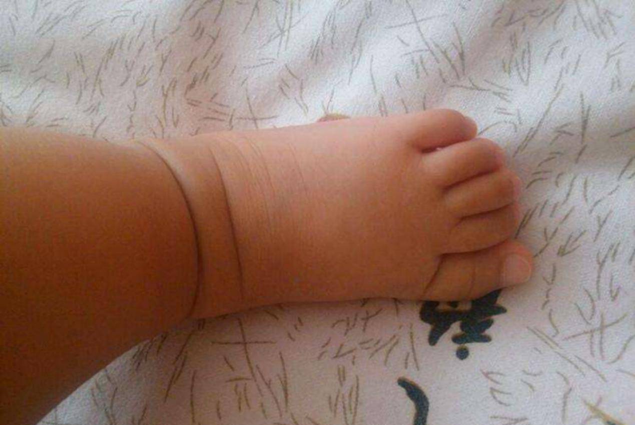 脚型能"预知未来"?心理学家:孩子是什么脚型,就是什么命