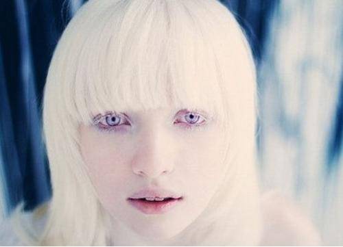 世界上最白的女孩儿,白的连血管都能看清,生活让人羡慕_女孩子