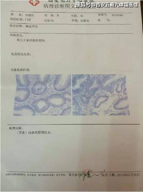 李學武膏方治療萎縮性胃炎腸化成功逆轉案例